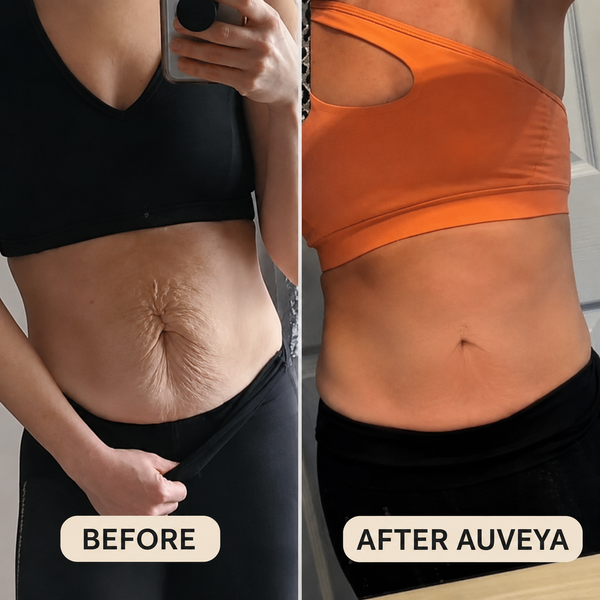 Auveya before and after result