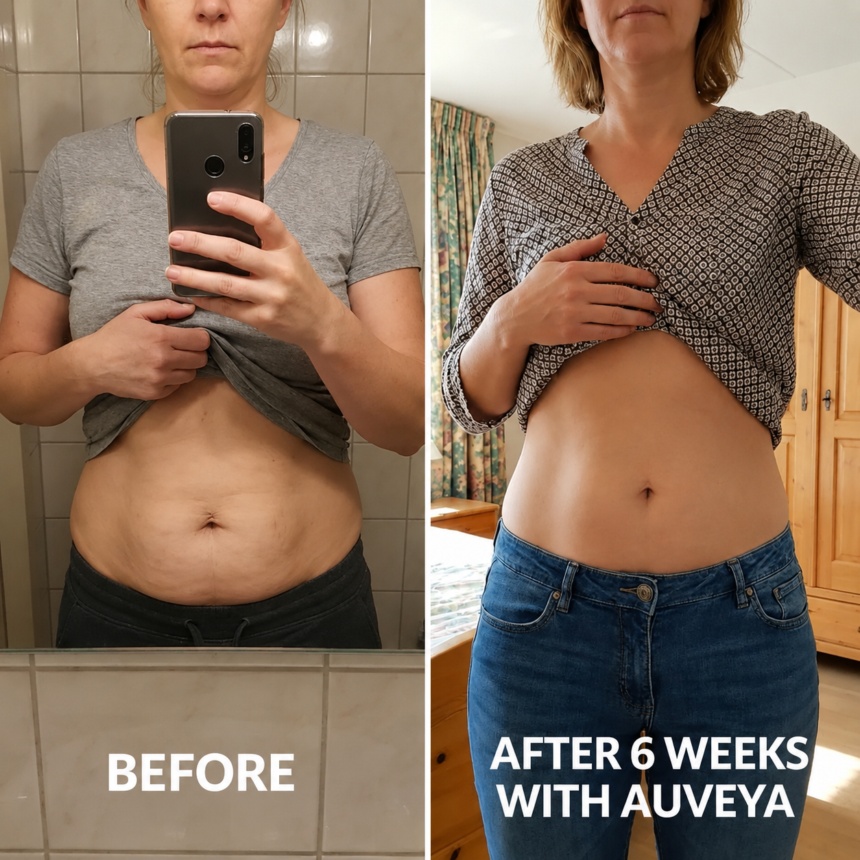 Auveya® BodySculpt kit
