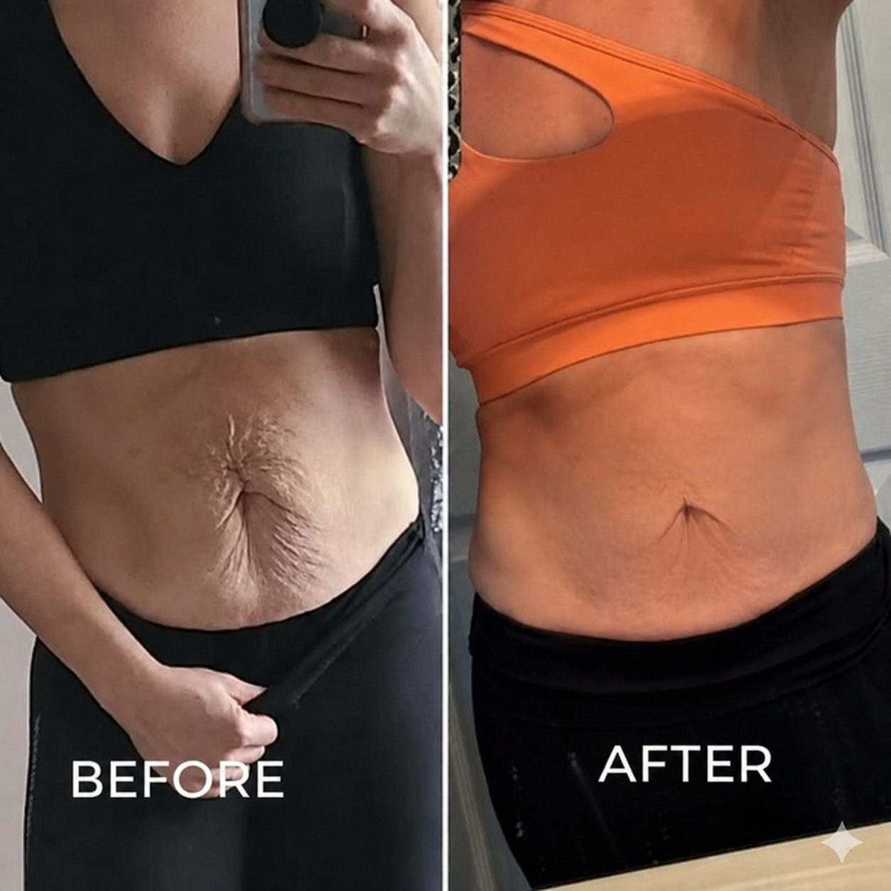 Auveya® BodySculpt kit